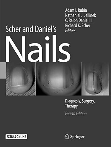 Stock image for Scher and Daniel's Nails for sale by Basi6 International