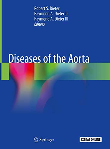 Beispielbild fr Diseases of the Aorta zum Verkauf von Jasmin Berger