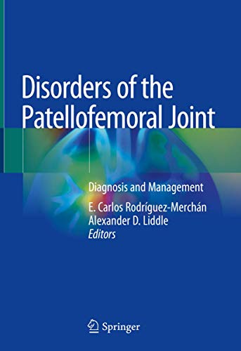 Beispielbild fr Disorders of the Patellofemoral Joint. Diagnosis and Management. zum Verkauf von Gast & Hoyer GmbH