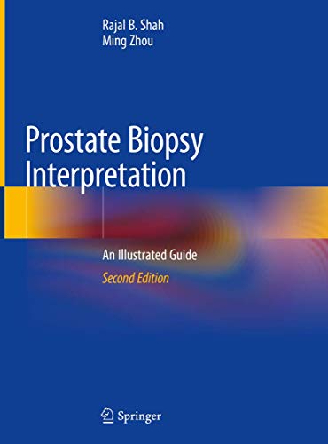 Stock image for Prostate Biopsy Interpretation: An Illustrated Guide for sale by SpringBooks