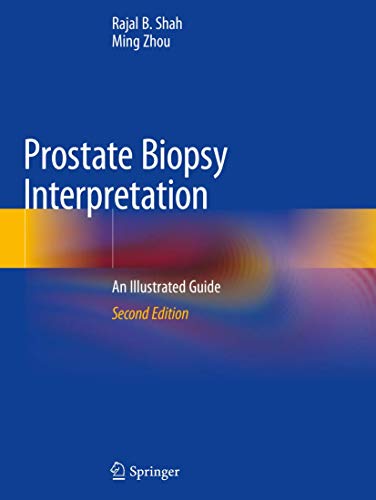 Stock image for Prostate Biopsy Interpretation: An Illustrated Guide for sale by GF Books, Inc.