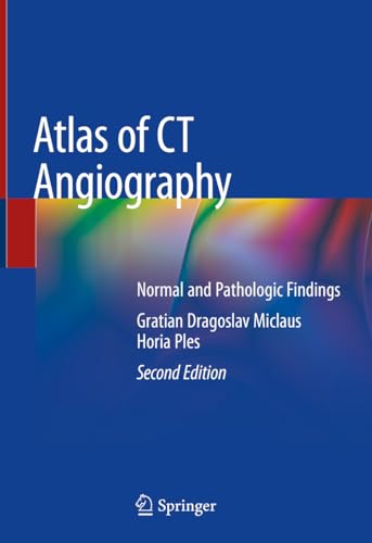 Beispielbild fr Atlas of CT Angiography. Normal and Pathologic Findings. zum Verkauf von Gast & Hoyer GmbH