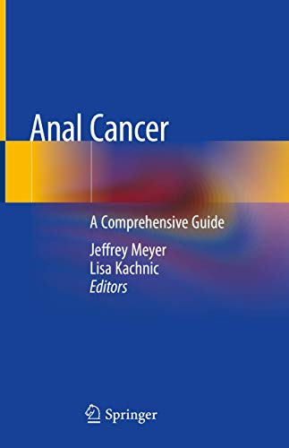 9783030202521: Anal Cancer: A Comprehensive Guide