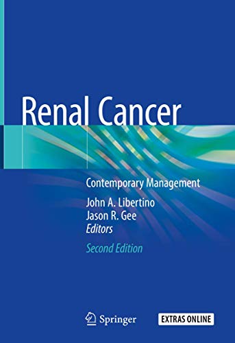 9783030243777: Renal Cancer: Contemporary Management
