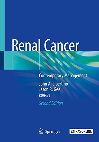 Imagen de archivo de Renal Cancer: Contemporary Management a la venta por Mispah books