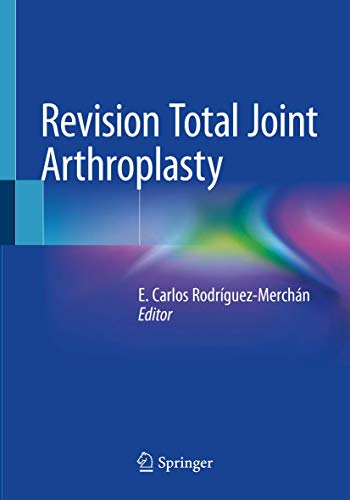 9783030247751: Revision Total Joint Arthroplasty