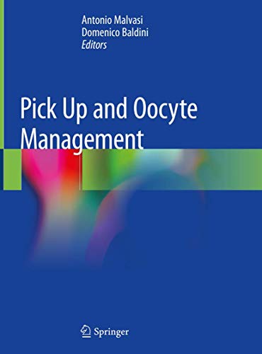 9783030287405: Pick Up and Oocyte Management
