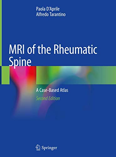 9783030329952: MRI of Rheumatic Spine: A Case-based Atlas