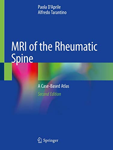 9783030329983: MRI of Rheumatic Spine: A Case-based Atlas