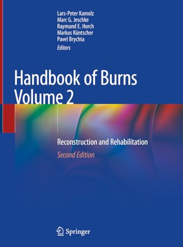 9783030345105: Handbook of Burns: Reconstruction and Rehabilitation