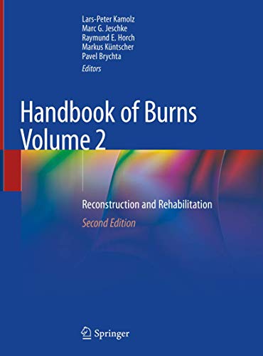 9783030345105: Handbook of Burns Volume 2: Reconstruction and Rehabilitation