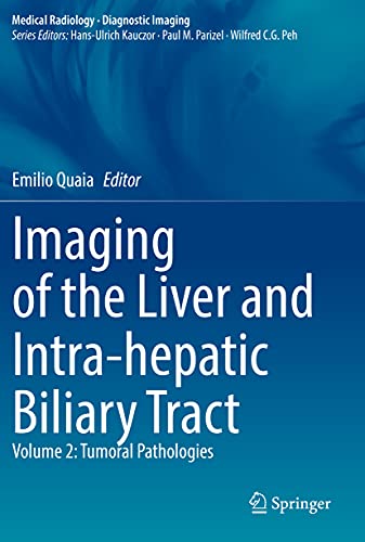 Beispielbild fr Imaging of the Liver and Intra-hepatic Biliary Tract: Volume 2: Tumoral Pathologies (Diagnostic Imaging) zum Verkauf von GF Books, Inc.