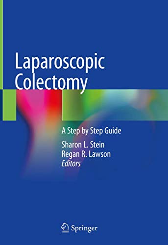 Stock image for Laparoscopic Colectomy: A Step by Step Guide for sale by HPB-Red