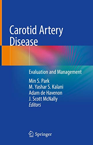 Stock image for Carotid Artery Disease: Evaluation and Management for sale by SecondSale