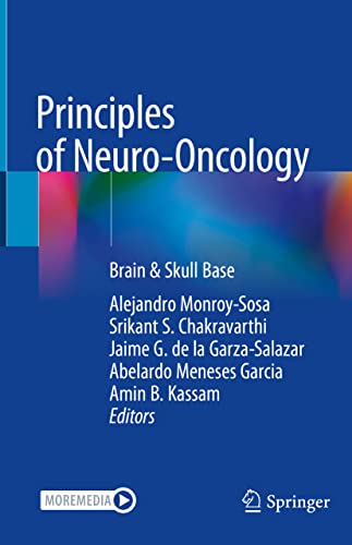 9783030548780: Principles of Neuro-Oncology: Brain & Skull Base