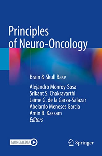 Stock image for Principles of Neuro-Oncology : Brain & Skull Base for sale by Ria Christie Collections