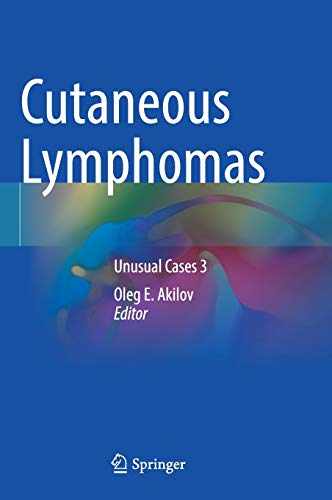 Beispielbild fr Cutaneous Lymphomas: Unusual Cases 3 zum Verkauf von SpringBooks