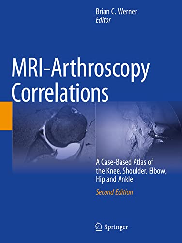 9783030947910: Mri-arthroscopy Correlations: A Case-based Atlas of the Knee, Shoulder, Elbow, Hip and Ankle