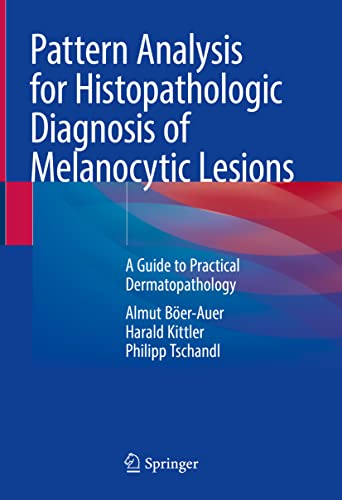 Beispielbild fr Pattern Analysis for Histopathologic Diagnosis of Melanocytic Lesions : A Guide to Practical Dermatopathology zum Verkauf von Buchpark