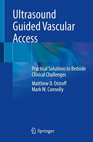 Beispielbild fr Ultrasound Guided Vascular Access: Practical Solutions to Bedside Clinical Challenges zum Verkauf von Monster Bookshop