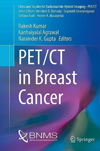 Beispielbild fr PET/CT in Breast Cancer zum Verkauf von Buchpark