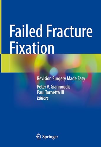 Imagen de archivo de FAILED FRACTURE FIXATION REVISION SURGERY MADE EASY (HB 2024) a la venta por Basi6 International