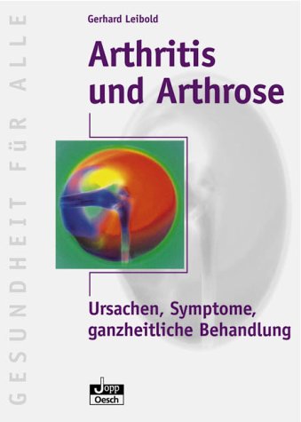 Beispielbild fr Arthritis und Arthrose zum Verkauf von Bookbot