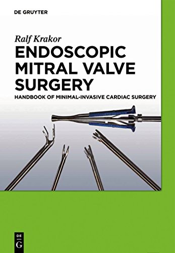 Stock image for Endoscopic Mitral Valve Surgery Handbook of MinimalInvasive Cardiac Surgery for sale by PBShop.store US