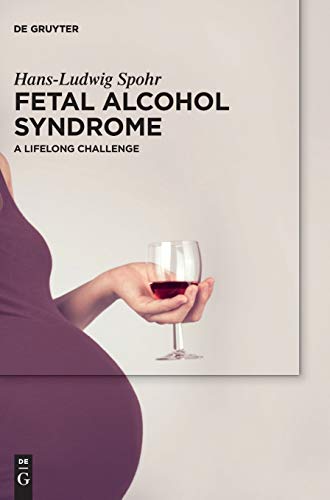 Stock image for Fetal Alcohol Syndrome: In Childhood and Adulthood for sale by Revaluation Books