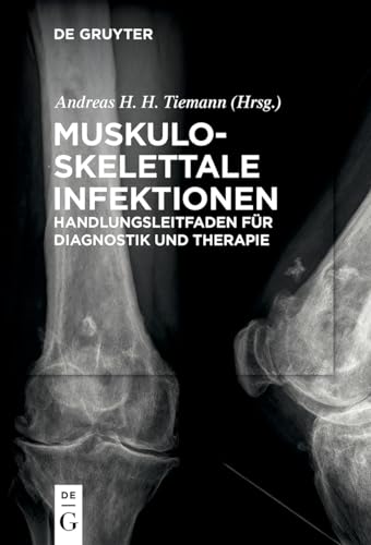 Beispielbild fr Muskuloskelettale Infektionen: Handlungsleitfaden fr Diagnostik und Therapie (German Edition) zum Verkauf von Lucky's Textbooks