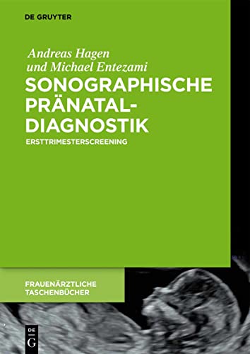 Imagen de archivo de Sonographische Prnataldiagnostik: Ersttrimesterscreening (Frauenrztliche Taschenbcher) (German Edition) a la venta por Lucky's Textbooks