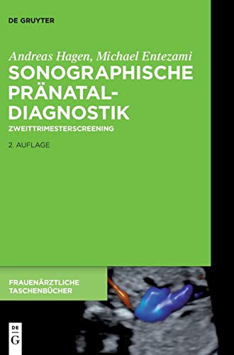 Imagen de archivo de Sonographische Prnataldiagnostik: Zweittrimesterscreening (Frauenrztliche Taschenbcher) (German Edition) a la venta por Lucky's Textbooks