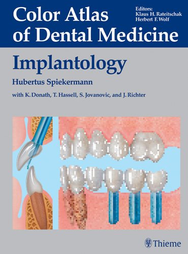 Stock image for Implantology for sale by Books Puddle