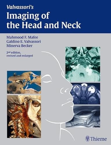 Imagen de archivo de Imaging of the Head and Neck a la venta por Books Puddle