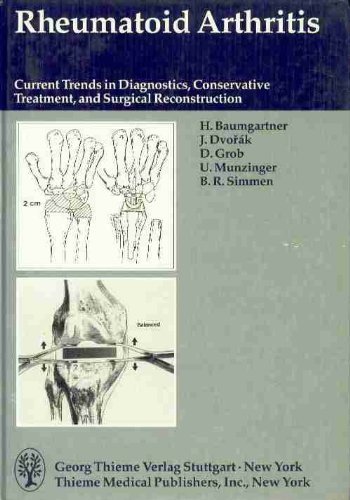 Imagen de archivo de Rheumatoid Arthritis: Current Trends in Diagnostics, Conservative Treatment and Surgical Reconstruction Baumgartner, H.; etc.; Dvorak, Jiri; Grob, Dieter; Munzinger, Urs and Simmen, Beat a la venta por online-buch-de