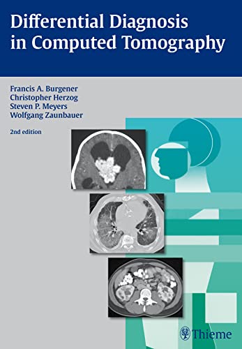 Imagen de archivo de Differential Diagnosis In Computed Tomography 2nd Ed a la venta por Libros del Mundo