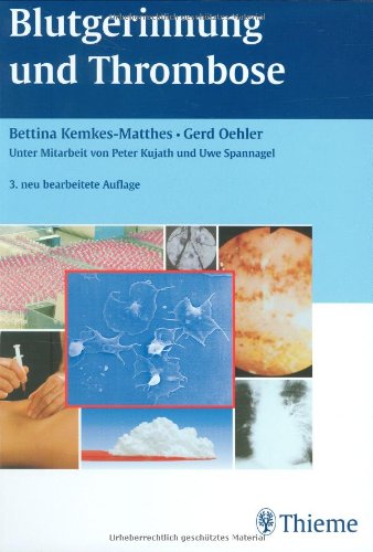 Beispielbild fr Blutgerinnung und Thrombose von Bettina Kemkes-Matthes (Autor), Gerd Oehler (Autor), Peter Kujath (Autor), Uwe Spannagel (Autor) zum Verkauf von BUCHSERVICE / ANTIQUARIAT Lars Lutzer