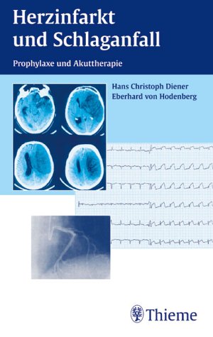 Beispielbild fr Herzinfarkt und Schlaganfall Manual zum Verkauf von medimops