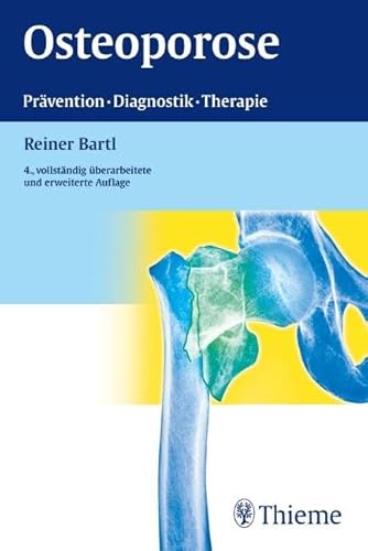 9783131057549: Osteoporose: Prvention - Diagnostik - Therapie