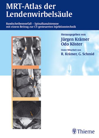 Beispielbild fr MRT-Atlas der Lendenwirbelsule Bandscheibenvorfall - Spinalkanalstenose. Mit einem Beitrag zur CT-gesteuerten Injektionstechnik [Gebundene Ausgabe] Jrgen Krmer Odo Kster Robert Krmer Gebhard Schmid Diagnostik klinische bildgebende Befunde Kernresonanztomographie Atlanten Kernresonanztomographie Atlas Lendenwirbelsule zum Verkauf von BUCHSERVICE / ANTIQUARIAT Lars Lutzer