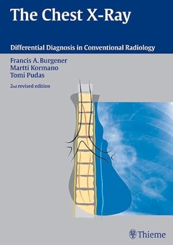 Imagen de archivo de The Chest X-Ray (Differential Diagnosis in Conventional Radiology) a la venta por medimops