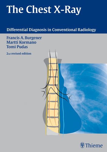 9783131076120: The Chest X-Ray (Differential Diagnosis in Conventional Radiology)