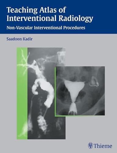 Imagen de archivo de Teaching atlas of interventional radiology. - a la venta por CSG Onlinebuch GMBH