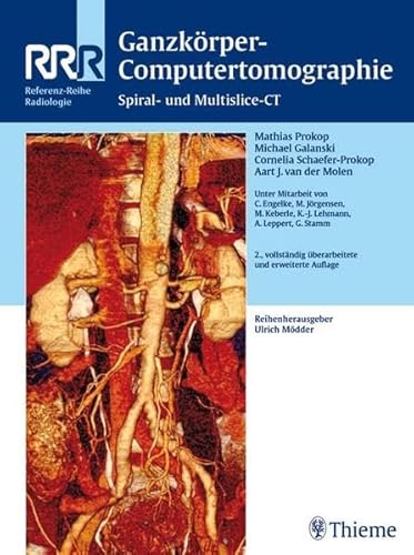 9783131089120: Ganzkrper-Computertomographie: Spiral- und Multislice-CT