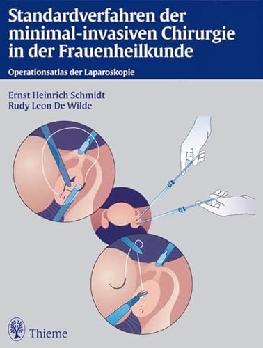 9783131101815: Standardverfahren der minimal-invasiven Chirurgie in der Frauenheilkunde: Operationsatlas der Laparoskopie