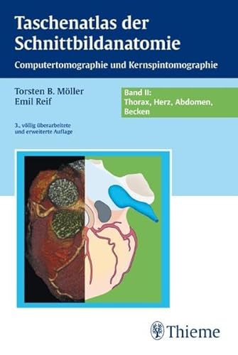 Taschenatlas der Schnittbildanatomie 2. Thorax, Abdomen, Becken (9783131108036) by Torsten Bert MÃ¶ller