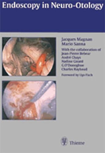Imagen de archivo de Endoscopy in Neuro-Otology and Skull Base Surgery (AT) a la venta por Blackwell's