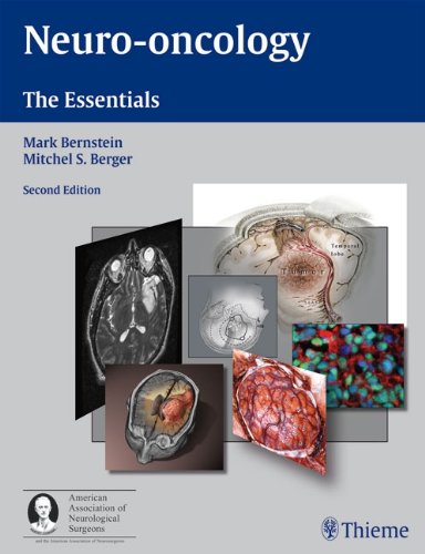 9783131163325: Neuro-oncology: The Essentials