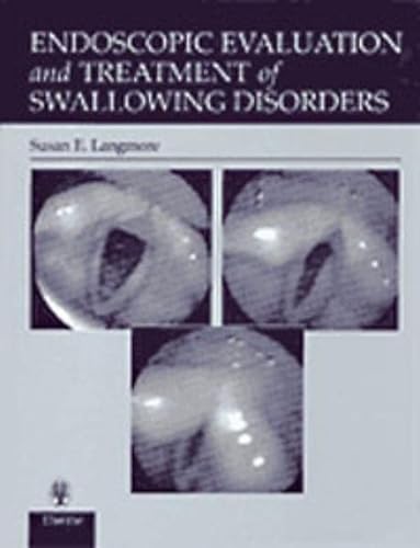 Imagen de archivo de Endoscopic Evaluation and Treatment of Swallowing Disorders a la venta por dsmbooks