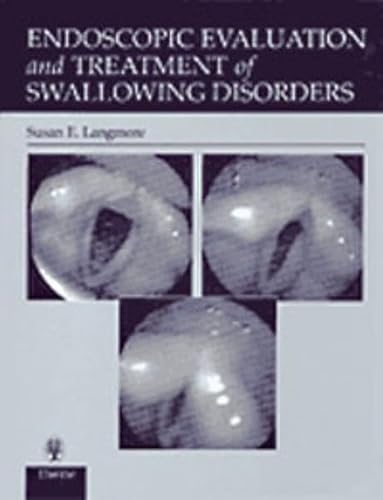 9783131163912: Endoscopic Evaluation and Treatment of Swallowing Disorders